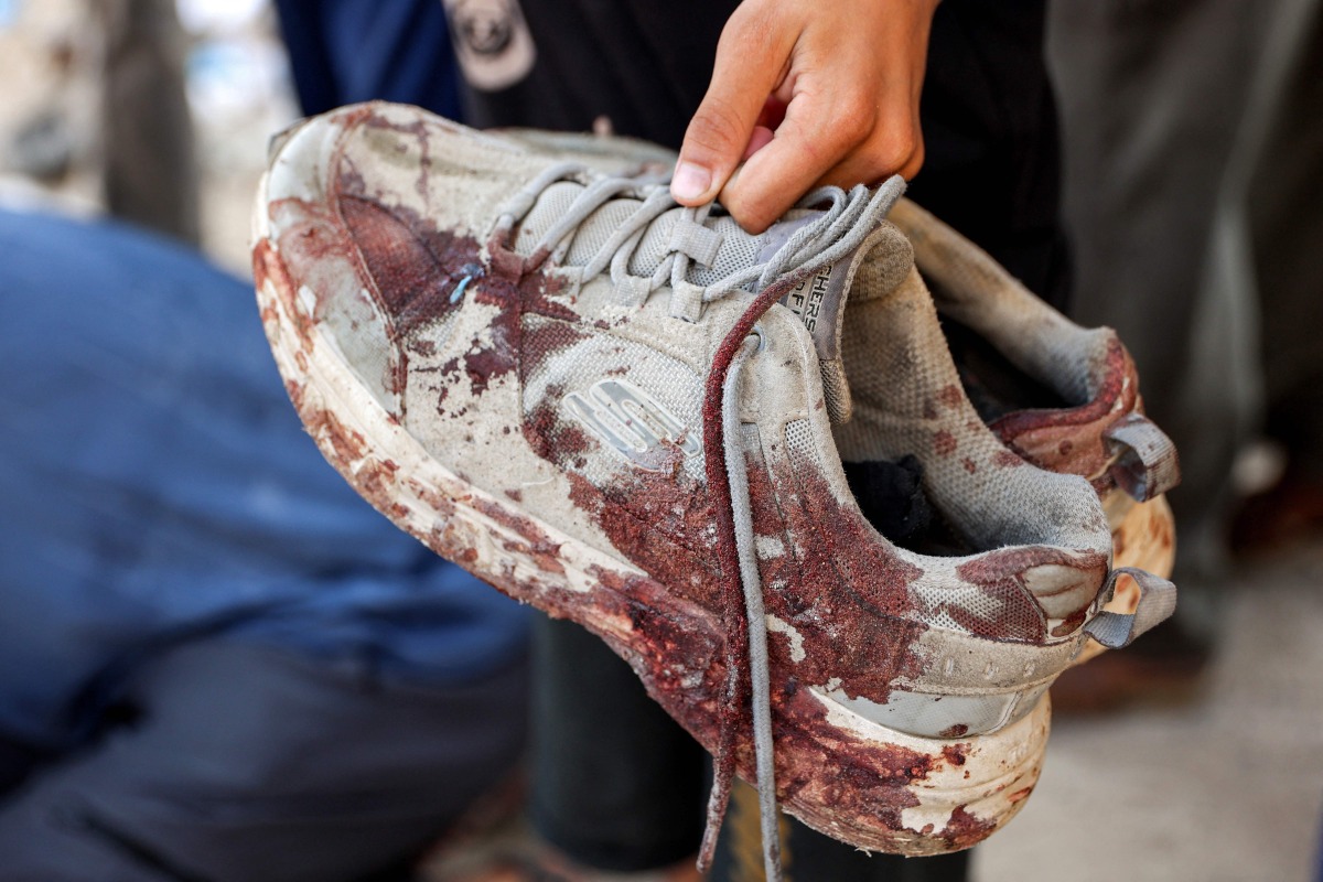 A person holds the bloodied shoes of young man who was killed by gunfire while waiting for aid trucks entering the northern Gaza Strip through the Zikim crossing, as people gather around the body at the Shifa Hospital in Gaza City on July 27, 2025. (Photo by Omar AL-QATTAA / AFP)